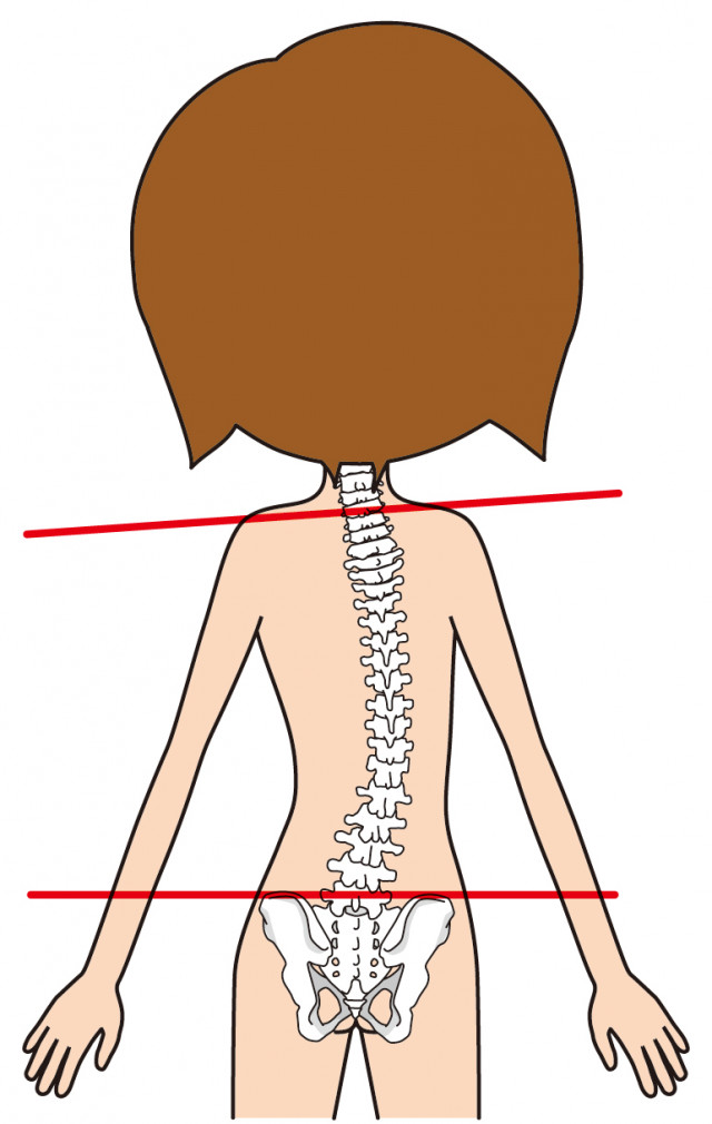 背骨のゆがみ